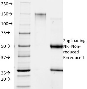 SDS-PAGE Analysis of Purified RANK Giardia lamblia Mouse Monoclonal Antibody (BB1.1E5). Confirmation of Purity and Integrity of Antibody.
