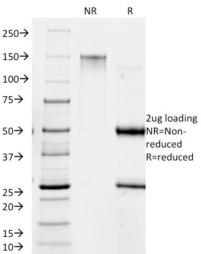 SDS-PAGE Analysis Purified RANK Giardia lamblia Mouse Monoclonal Antibody (BB1.1E5). Confirmation of Purity and Integrity of Antibody.