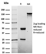 SDS-PAGE Analysis of Purified Penicillin Mouse Monoclonal Antibody (Pen-9) Confirmation of Integrity and Purity of Antibody.