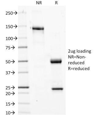 SDS-PAGE Analysis Purified Phosphotyrosine Mouse Monoclonal Antibody (PY20). Confirmation of Purity and Integrity of Antibody.