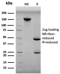 SDS-PAGE Analysis Purified Progesterone Mouse Monoclonal Antibody (6-5E-3F). Confirmation of Purity and Integrity of Antibody