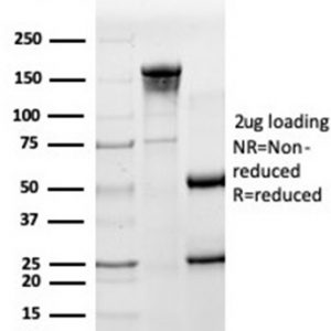 SDS-PAGE Analysis of Purified HA-Tag Mouse Monoclonal Antibody (HA/279). Confirmation of Purity and Integrity of Antibody.