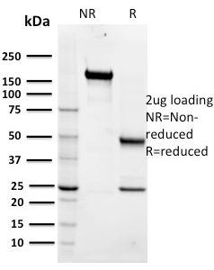 SDS-PAGE Analysis of Purified Maltose Binding Protein Mouse Monoclonal Antibody (R29.6). Confirmation of Integrity and Purity of Antibody.