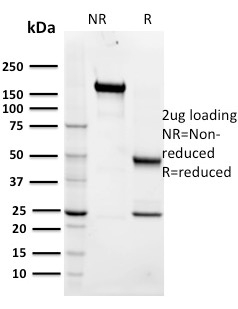 SDS-PAGE Analysis Purified Maltose Binding Protein Mouse Monoclonal Antibody (R29.6). Confirmation of Integrity and Purity of Antibody.