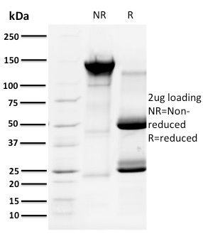 SDS-PAGE Analysis of Purified Cyclin A1 Mouse Monoclonal Antibody (XLA1-3). Confirmation of Purity and Integrity of Antibody.