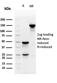 SDS-PAGE Analysis Purified Myofibroblast Marker Mouse Monoclonal Antibody (PR 2D3). Confirmation of Purity and Integrity of Antibody.