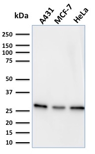 Western Blot Analysis of A431, MCF-7 & HeLa cell lysates using Myofibroblast Marker Mouse Monoclonal Antibody (PR 2D3).