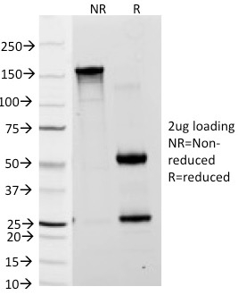 SDS-PAGE Analysis Purified Lewis A Monoclonal Antibody (7LE). Confirmation of Purity and Integrity of Antibody.