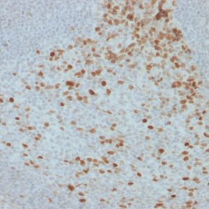 Formalin-fixed, paraffin-embedded human Lymph Node stained with Proliferation Marker Mouse Monoclonal Antibody (JC1).