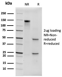 SDS-PAGE Analysis of Purified Anti-Hexa-histidine Mouse Monoclonal 6HIS/3550). Confirmation of Integrity and Purity of Antibody.