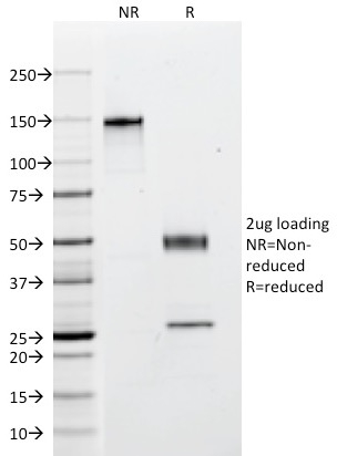 SDS-PAGE Analysis Purified Multi Cytokeratin Mouse Monoclonal Antibody (C11).