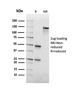 SDS-PAGE Analysis Purified Anti-Biotin Mouse Monoclonal antibody (Hyb-8). Confirmation of Purity and Integrity of Antibody.