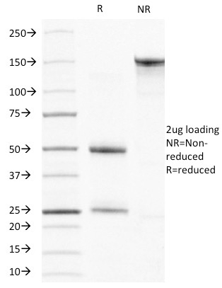 SDS-PAGE Analysis Purified Muscle Specific Actin Mouse Monoclonal Antibody (HHF35). Confirmation of Purity and Integrity of Antibody.
