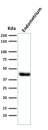 Western Blot Analysis of Endometrium muscle tissue lysate using Muscle Specific Actin Mouse Monoclonal Antibody (HHF35).