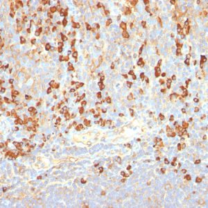 Formalin-fixed, paraffin-embedded human Tonsil stained with Plasma Cell Marker Monoclonal Antibody (LIV3G11).