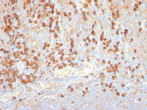 Formalin-fixed, paraffin-embedded human Tonsil stained with Plasma Cell Marker Monoclonal Antibody (LIV3G11).