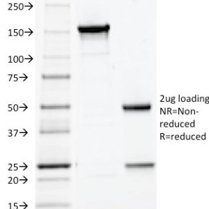 SDS-PAGE Analysis of Purified HPV-16 Monoclonal Antibody (CAMVIR-1). Confirmation of Purity and Integrity of Antibody.