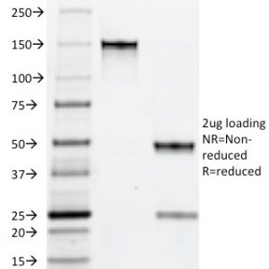 SDS-PAGE Analysis of Purified Myeloid Specific Monoclonal Antibody (BM-1). Confirmation of Purity and Integrity of Antibody.