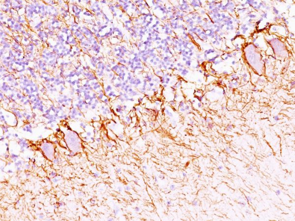 Formalin-fixed, paraffin-embedded human Cerebellum stained with Neurofilament Mouse Monoclonal Antibody (NF421 + NFL/736).
