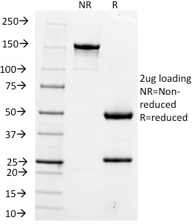 SDS-PAGE Analysis Purified Hepatocyte Specific Antigen Mouse Monoclonal Antibody (OCH1E5). Confirmation of Purity and Integrity of Antibody.