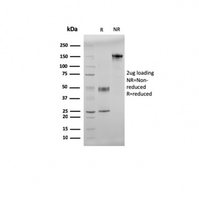 SDS-PAGE Analysis Purified Double Stranded DNA Mouse Monoclonal Antibody (121-3). Confirmation of Purity and Integrity of Antibody.