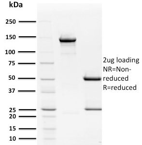 SDS-PAGE Analysis of Purified Mouse Monoclonal Antibody HPV16 E2 (Human Papilloma Virus 16). Confirmation of Purity and Integrity of Antibody.