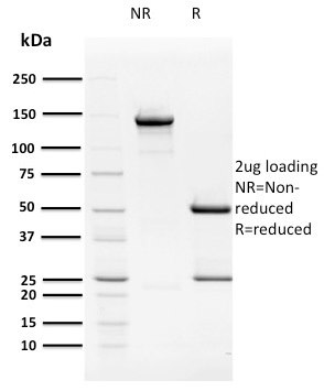SDS-PAGE Analysis Purified Mouse Monoclonal Antibody HPV16 E2 (Human Papilloma Virus 16). Confirmation of Purity and Integrity of Antibody.