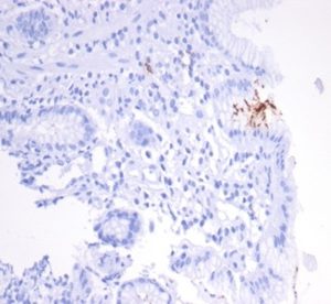 Formalin-fixed, paraffin-embedded human H. pylori-infected stomach stained with Helicobacter pylori (Catalase) Mouse Monoclonal Antibody (HPYL/7170).