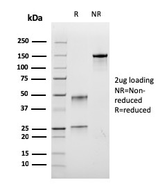 SDS-PAGE Analysis of Purified BrdU Recombinant Mouse Monoclonal Antibody (rBRD.3). Confirmation of Purity and Integrity of Antibody.