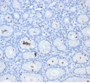 Formalin-fixed, paraffin-embedded human H. pylori-infected stomach stained with Helicobacter pylori (Catalase) Mouse Monoclonal Antibody (HPYL/7171).