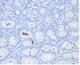 Formalin-fixed, paraffin-embedded human H. pylori-infected stomach stained with Helicobacter pylori (Catalase) Mouse Monoclonal Antibody (HPYL/7171).