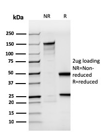 SDS-PAGE Analysis of Purified BrdU Recombinant Mouse Monoclonal Antibody (rBRD494). Confirmation of Purity and Integrity of Antibody.