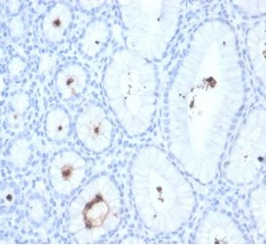 Formalin-fixed, paraffin-embedded human H. pylori-infected stomach stained with Helicobacter pylori (Catalase) Mouse Monoclonal Antibody (HPYL/7172).