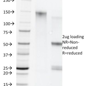SDS-PAGE Analysis of Purified Cytokeratin 5/8 Monoclonal Antibody (C-50). Confirmation of Purity and Integrity of Antibody.