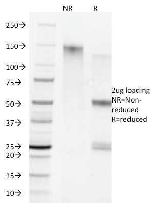 SDS-PAGE Analysis Purified Cytokeratin 5/8 Monoclonal Antibody (C-50). Confirmation of Purity and Integrity of Antibody.