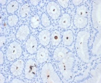 Formalin-fixed, paraffin-embedded H. pylori-infected human stomach stained with Helicobacter pylori (Catalase) Mouse Monoclonal Antibody (HPYL/7226).