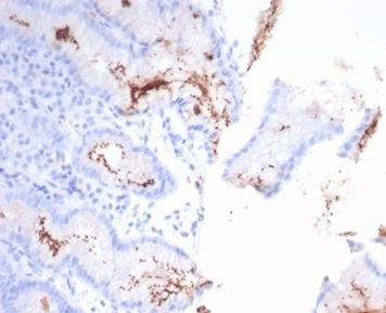 Formalin-fixed, paraffin-embedded H. pylori-infected human stomach stained with Helicobacter pylori (Catalase) Mouse Monoclonal Antibody (HPYL/7226).
