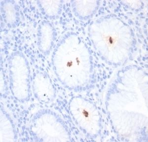 Formalin-fixed, paraffin-embedded H. pylori-infected human stomach stained with Helicobacter pylori (Catalase) Mouse Monoclonal Antibody (HPYL/7227).