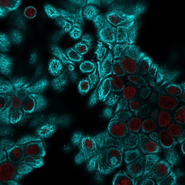 Confocal immunofluorescent analysis of HeLa cells using Pan-Cytokeratin Mouse Monoclonal Antibody (PAN-CK) followed by goat anti-mouse IgG-CF488 (cyan). Nuclei are counterstained with NucSpot (red).