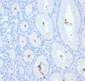 Formalin-fixed, paraffin-embedded H. pylori-infected human stomach stained with Helicobacter pylori (Catalase) Mouse Monoclonal Antibody (HPYL/7228).