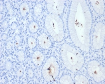 Formalin-fixed, paraffin-embedded H. pylori-infected human stomach stained with Helicobacter pylori (Catalase) Mouse Monoclonal Antibody (HPYL/7228).