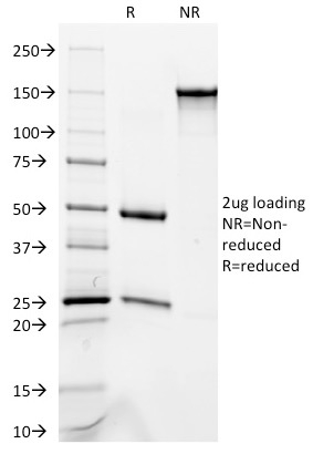SDS-PAGE Analysis Purified Cytokeratin 8/18 Monoclonal Antibody (C-51). Confirmation of Purity and Integrity of Antibody.