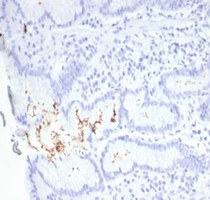 Formalin-fixed, paraffin-embedded H. pylori-infected human stomach stained with Helicobacter pylori (Catalase) Mouse Monoclonal Antibody (HPYL/7229).
