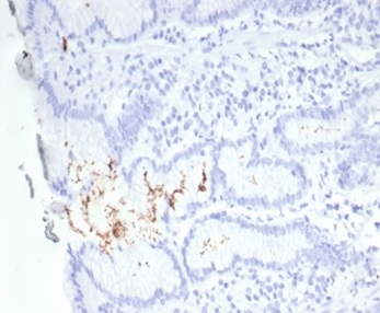 Formalin-fixed, paraffin-embedded H. pylori-infected human stomach stained with Helicobacter pylori (Catalase) Mouse Monoclonal Antibody (HPYL/7229).