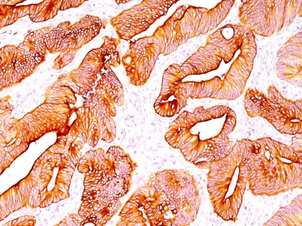 Formalin-fixed, paraffin-embedded colon (10X) stained with Multi Keratin Monoclonal Antibody (SPM583).
