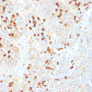 Formalin-fixed, paraffin-embedded human Tonsil stained with Plasma Cell Marker Monoclonal Antibody (SPM310).