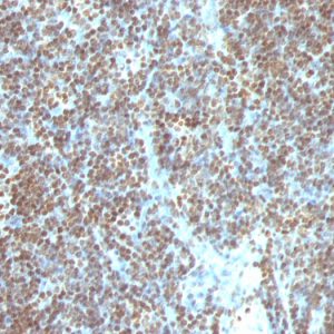 Formalin-fixed, paraffin-embedded human Tonsil stained with Double Stranded DNA Monoclonal Antibody (SPM603)
