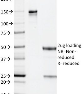SDS-PAGE Analysis of Purified CMV-p65 Mouse Monoclonal Antibody (CMV101). Confirmation of Purity and Integrity of Antibody.