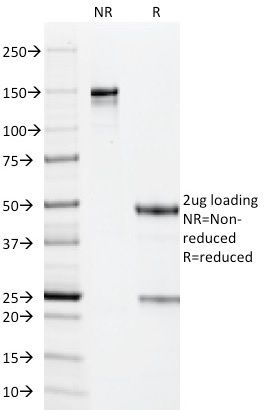 SDS-PAGE Analysis Purified CMV-p65 Mouse Monoclonal Antibody (CMV101). Confirmation of Purity and Integrity of Antibody.