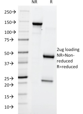SDS-PAGE Analysis of Purified Lewis Y Mouse Monoclonal Antibody (A70-A/A9). Confirmation of Purity and Integrity of Antibody.